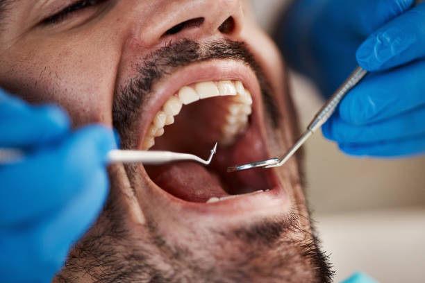 Best Sedation Dentistry  in Pflugerville, TX